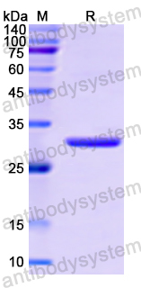 Recombinant Human ACTR3 Protein, N-His