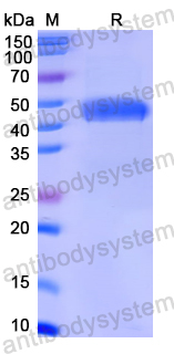 Recombinant Human ACTR2 Protein, N-His