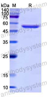 Recombinant Human COPS2 Protein, N-His