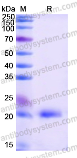 Recombinant Human RAP1B Protein, N-His