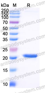 Recombinant Human MAX Protein, C-His