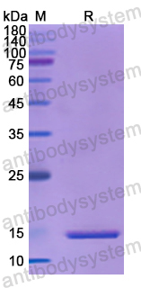 Recombinant Human SST Protein, N-His
