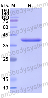 Recombinant Human ISL1 Protein, N-His