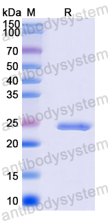 Recombinant Human NCALD Protein, N-His