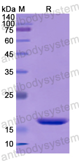 Recombinant Human LYZ Protein, N-His