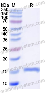 Recombinant Human B2M Protein, N-His