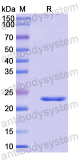 Recombinant Human RPS7 Protein, N-His