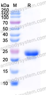 Recombinant Human RPS7 Protein, C-His