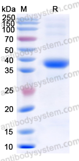 Recombinant Human PPP1CA Protein, N-His