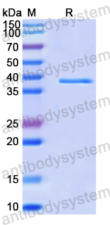 Recombinant Human PPP1CB Protein, N-His