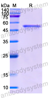 Recombinant Human PSMC1 Protein, N-His