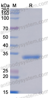 Recombinant Human YWHAE Protein, N-His