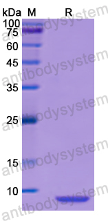 Recombinant Human TMSB4X Protein, N-His