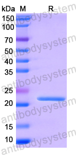 Recombinant Human ARF6 Protein, N-His