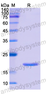 Recombinant Human RHOB Protein, N-His