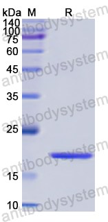 Recombinant Human VSNL1 Protein, N-His