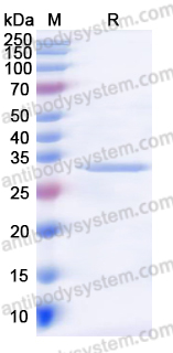 Recombinant Human VSNL1 Protein, N-His