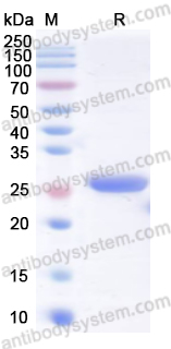 Recombinant Human RAB1A Protein, N-His