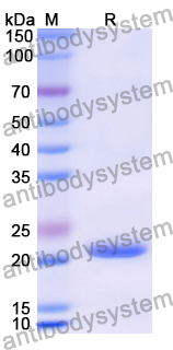 Recombinant Human RAN Protein, N-His