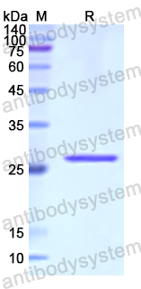 Recombinant Human RPL10A Protein, N-His