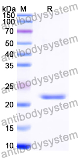 Recombinant Human RPL11 Protein, N-His