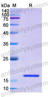 Recombinant Human UBA52 Protein, N-His
