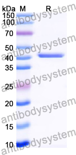 Recombinant Human UBA52 Protein, N-GST