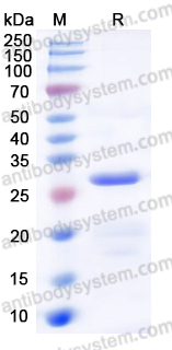 Recombinant Human GRB2 Protein, C-His