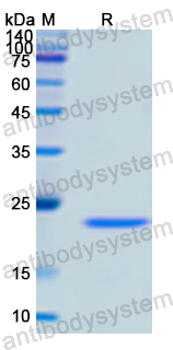 Recombinant Human RAC1 Protein, N-His