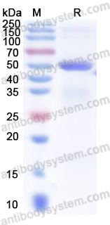 Recombinant Human GNAS Protein, N-His