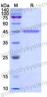 Recombinant Human PPP3R1 Protein, N-GST