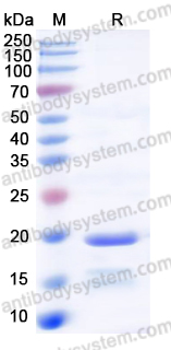 Recombinant Human PPP3R1 Protein, N-His
