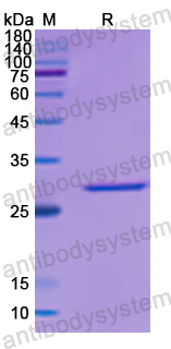 Recombinant Human YWHAZ Protein, N-His
