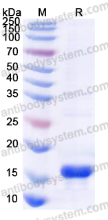 Recombinant Human UBE2B Protein, Tag free