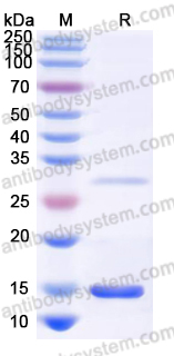 Recombinant Human DYNLL1 Protein, N-His