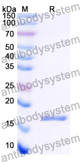 Recombinant Human DYNLT1 Protein, N-His