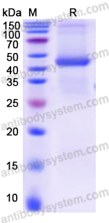 Recombinant Human ACTG2 Protein, N-His