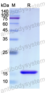 Recombinant Human UBE2I/UBC9 Protein, N-His