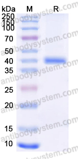 Recombinant Human UBE2I/UBC9 Protein, N-GST