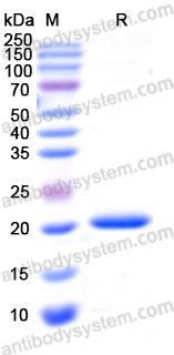 Recombinant Human TNNC1 Protein, N-His