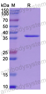 Recombinant Human PPP2CA Protein, N-His