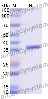 Recombinant Human YBX1 Protein, N-GST & C-His