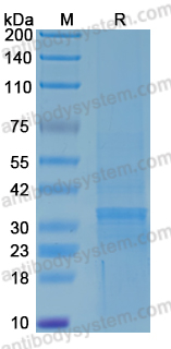 Recombinant Human YBX1 Protein, N-GST