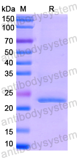 Recombinant Human CSNK2B Protein, N-His
