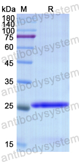 Recombinant Human ACTC1 Protein, N-His