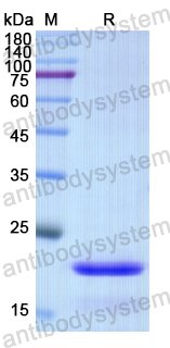 Recombinant Human UBE2L3 Protein, N-His
