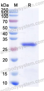 Recombinant Human EEF1A1 Protein, N-His