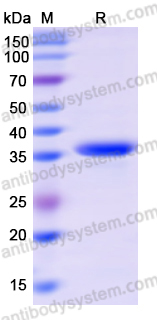Recombinant Human CSNK2A1/CK2A1 Protein, N-His