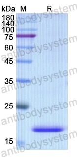 Recombinant Human HBB Protein, N-His