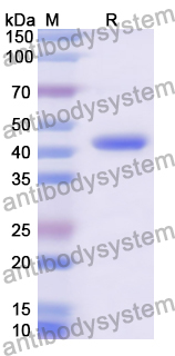Recombinant Human HBB Protein, N-GST & C-His
